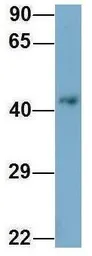 Anti-WDR21A antibody, Internal used in Western Blot (WB). GTX45305