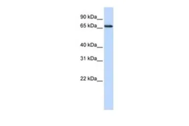 Anti-WDSOF1 antibody, N-term used in Western Blot (WB). GTX45310