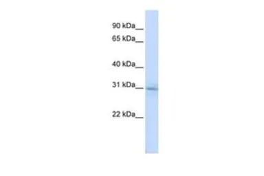 Anti-METTL5 antibody, N-term used in Western Blot (WB). GTX45351