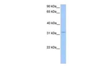 Anti-KCTD21 antibody, N-term used in Western Blot (WB). GTX45414