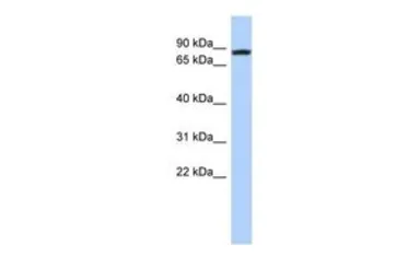 Anti-LOC81691 antibody, Internal used in Western Blot (WB). GTX45455