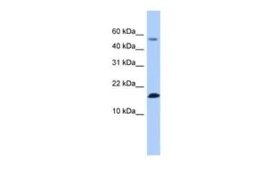 Anti-LYZL6 antibody, N-term used in Western Blot (WB). GTX45465