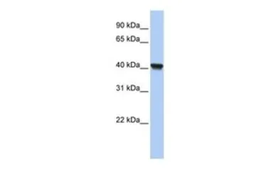 Anti-RLBP1L1 antibody, N-term used in Western Blot (WB). GTX45573