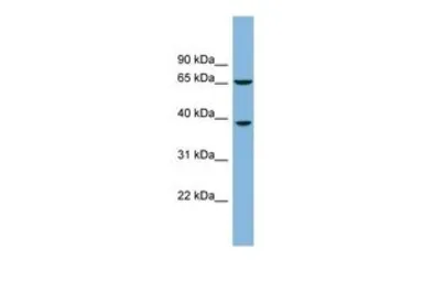 Anti-RLBP1L1 antibody, Internal used in Western Blot (WB). GTX45574