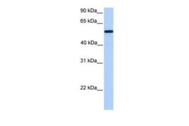 Anti-UGT2A3 antibody, Internal used in Western Blot (WB). GTX45973