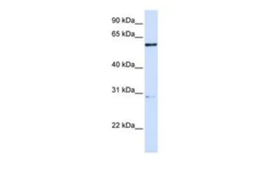 Anti-MANEA antibody, Internal used in Western Blot (WB). GTX45981