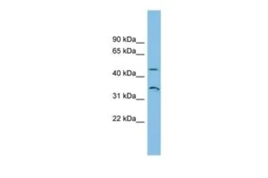 Anti-RHBG antibody, N-term used in Western Blot (WB). GTX46059