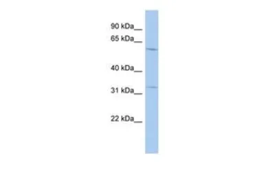 Anti-TRMT61B antibody, N-term used in Western Blot (WB). GTX46187