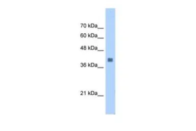 Anti-Aldolase A antibody, N-term used in Western Blot (WB). GTX46257