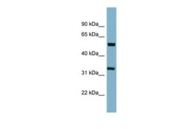 Anti-TMEM158 antibody, Internal used in Western Blot (WB). GTX46356