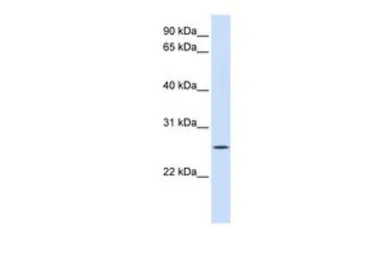 Anti-UNC50 antibody, N-term used in Western Blot (WB). GTX46378