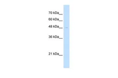 Anti-RTN2 antibody, N-term used in Western Blot (WB). GTX46422