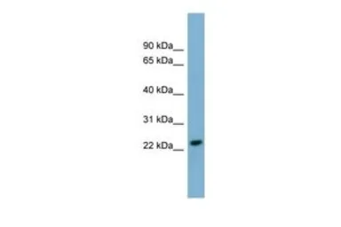 Anti-KLRC3 antibody, N-term used in Western Blot (WB). GTX46566