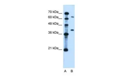 Anti-LRRC26 antibody, Internal used in Western Blot (WB). GTX46663