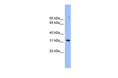 Anti-LRRC52 antibody, N-term used in Western Blot (WB). GTX46708