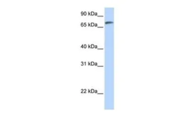 Anti-C14ORF37 antibody, N-term used in Western Blot (WB). GTX46733