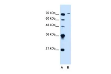 Anti-SLCO6A1 antibody, C-term used in Western Blot (WB). GTX46762