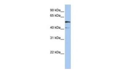 Anti-SLC23A3 antibody, N-term used in Western Blot (WB). GTX46775