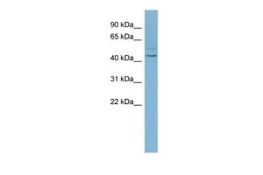 Anti-SLC46A1 antibody, N-term used in Western Blot (WB). GTX46780