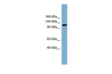 Anti-KCC2 antibody, Internal used in Western Blot (WB). GTX46802