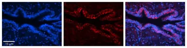 Anti-MCT1 antibody, Internal used in IHC (Paraffin sections) (IHC-P). GTX46839