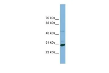 Anti-MCT1 antibody, Internal used in Western Blot (WB). GTX46839