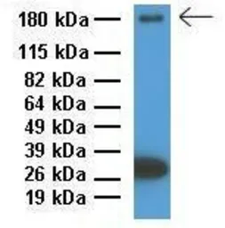 Anti-ABCC9 antibody, Internal used in Western Blot (WB). GTX46867