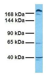 Anti-ABCC9 antibody, Internal used in Western Blot (WB). GTX46867