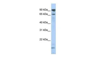 Anti-MSL2L1 antibody, N-term used in Western Blot (WB). GTX46913