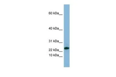 Anti-SPRR3 antibody, Internal used in Western Blot (WB). GTX47059