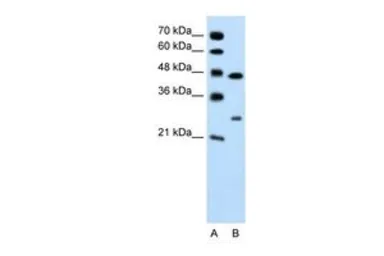 Anti-Claudin 18 antibody, C-term used in Western Blot (WB). GTX47158