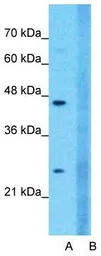 Anti-Claudin 18 antibody, C-term used in Western Blot (WB). GTX47158