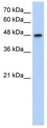 Anti-MAT1A antibody, N-term used in Western Blot (WB). GTX47163