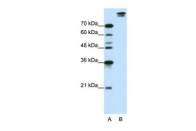 Anti-SF3B1 antibody, N-term used in Western Blot (WB). GTX47327