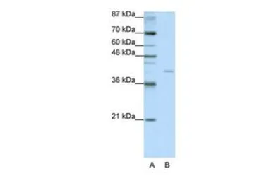 Anti-EIF3G antibody, N-term used in Western Blot (WB). GTX47376
