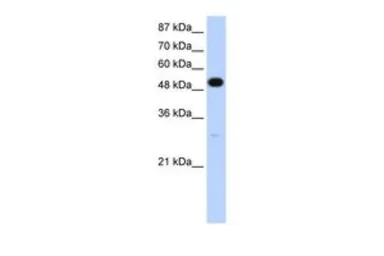 Anti-NOVA2 antibody, N-term used in Western Blot (WB). GTX47395