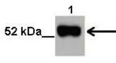 Anti-NOVA2 antibody, N-term used in Western Blot (WB). GTX47395