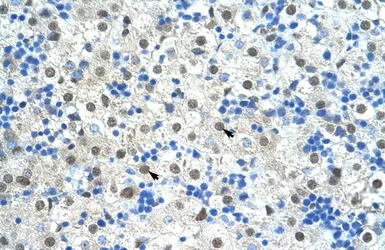 Anti-SF3B1 antibody, N-term used in IHC (Paraffin sections) (IHC-P). GTX47417