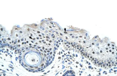 Anti-SF3B1 antibody, N-term used in IHC (Paraffin sections) (IHC-P). GTX47417