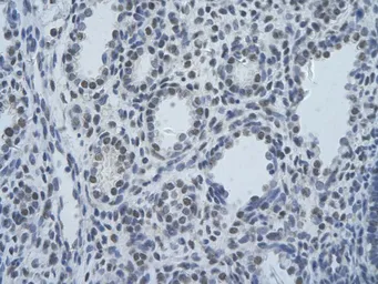 Anti-SF3B1 antibody, N-term used in IHC (Paraffin sections) (IHC-P). GTX47417