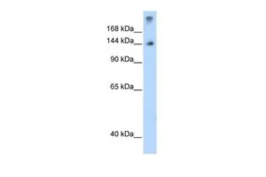 Anti-SF3B1 antibody, N-term used in Western Blot (WB). GTX47417