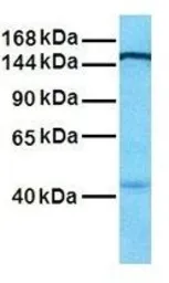 Anti-SF3B1 antibody, N-term used in Western Blot (WB). GTX47417