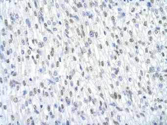 Anti-SF3B1 antibody, Internal used in IHC (Paraffin sections) (IHC-P). GTX47418