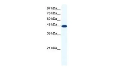 Anti-ACCN5 antibody, Internal used in Western Blot (WB). GTX47443