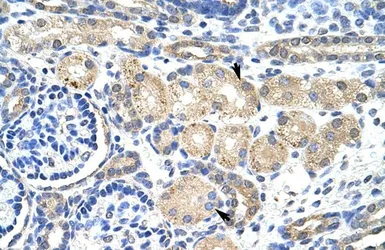 Anti-KCNAB2 antibody, Internal used in IHC (Paraffin sections) (IHC-P). GTX47448