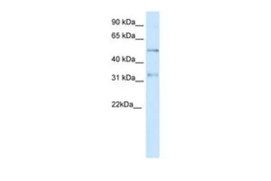 Anti-KCNAB2 antibody, Internal used in Western Blot (WB). GTX47448