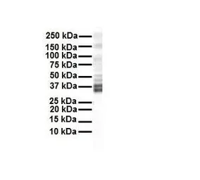 Anti-KCNAB2 antibody, Internal used in Western Blot (WB). GTX47448