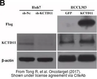 Anti-KCTD11 antibody, N-term used in Western Blot (WB). GTX47451