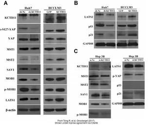 Anti-KCTD11 antibody, N-term used in Western Blot (WB). GTX47451