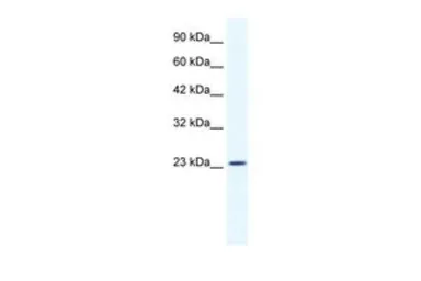 Anti-KCTD11 antibody, N-term used in Western Blot (WB). GTX47451